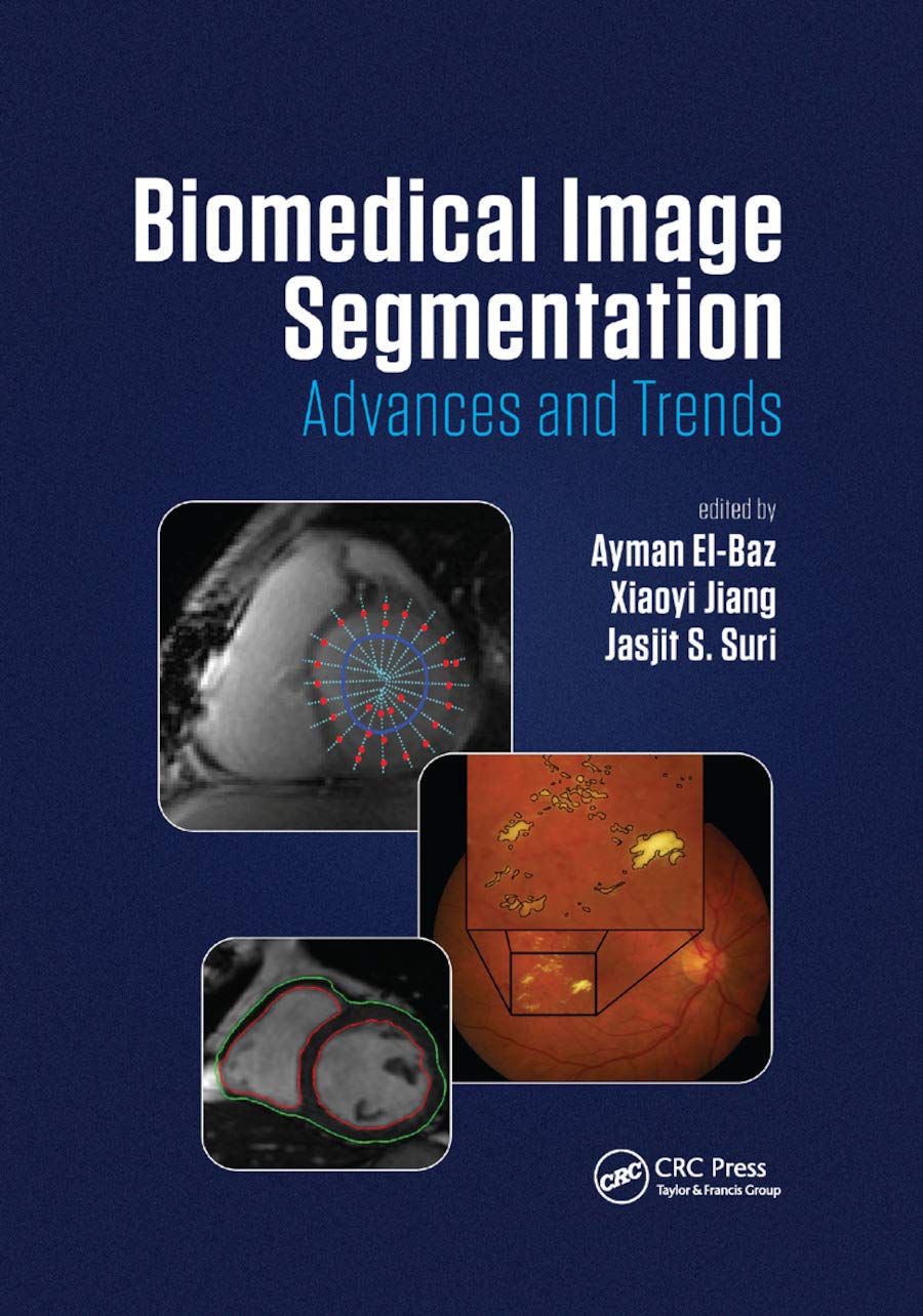 Biomedical Image Segmentation Medicine