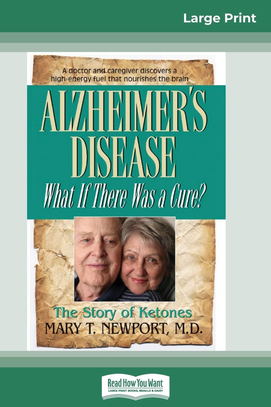Alzheimer's Disease: What If There Was a Cure? (16pt Large Print Edition) Medicine
