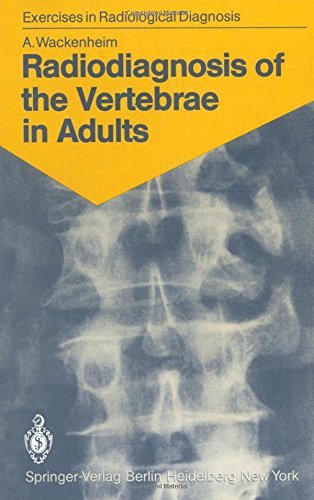 Radiodiagnosis of the vertebrae in adults: 125 exercises for students and practitioners (Exercises in radiological diagnosis) Books