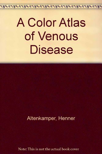 Color Atlas of Venous Disease Medicine