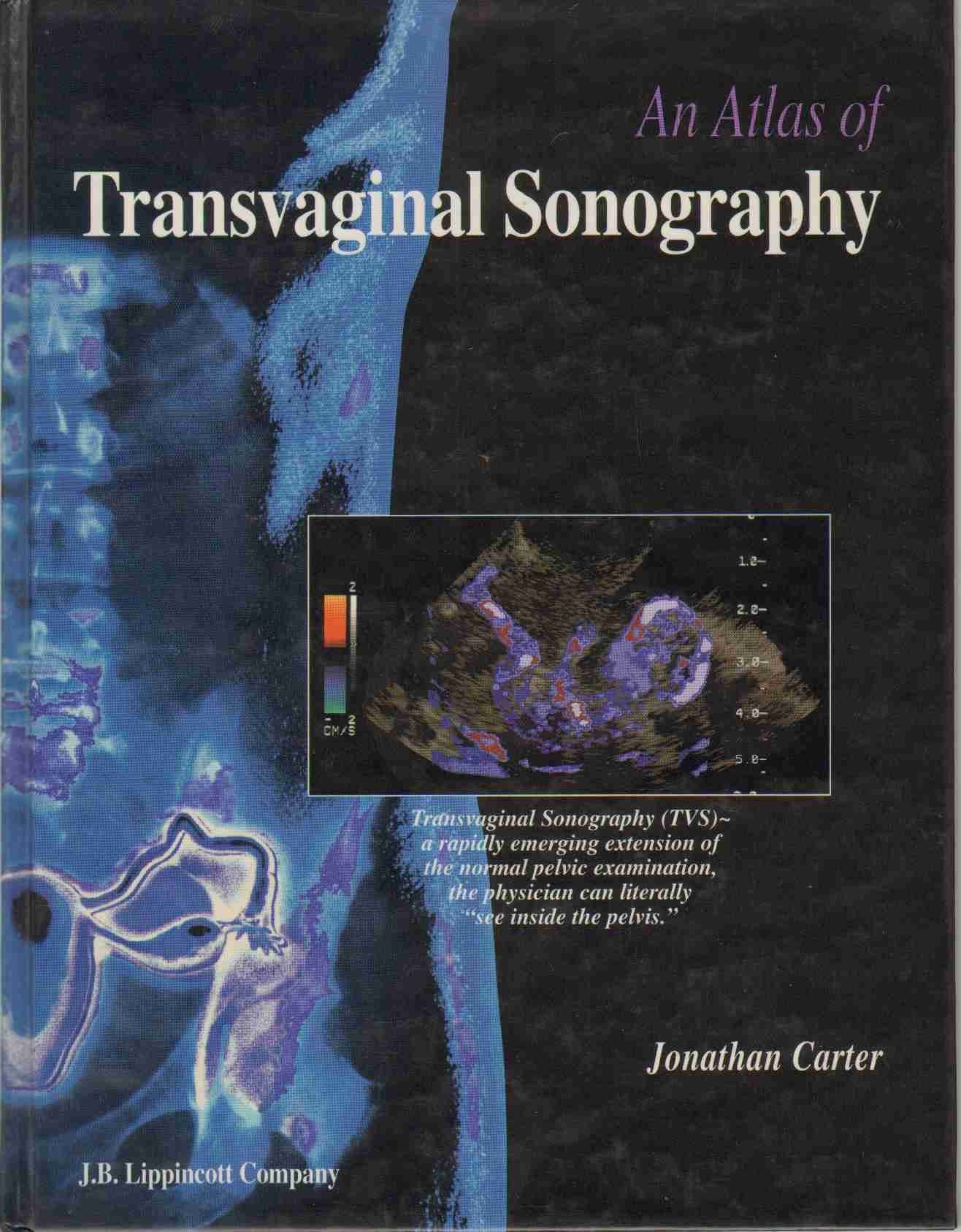 An Atlas of Transvaginal Sonography Medicine