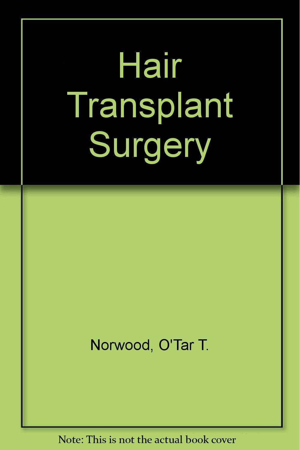 Hair Transplant Surgery Medicine