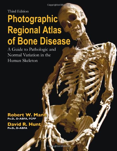 Photographic Regional Atlas of Bone Disease: A Guide to Pathologic and Normal Variation in the Human Skeleton Medicine