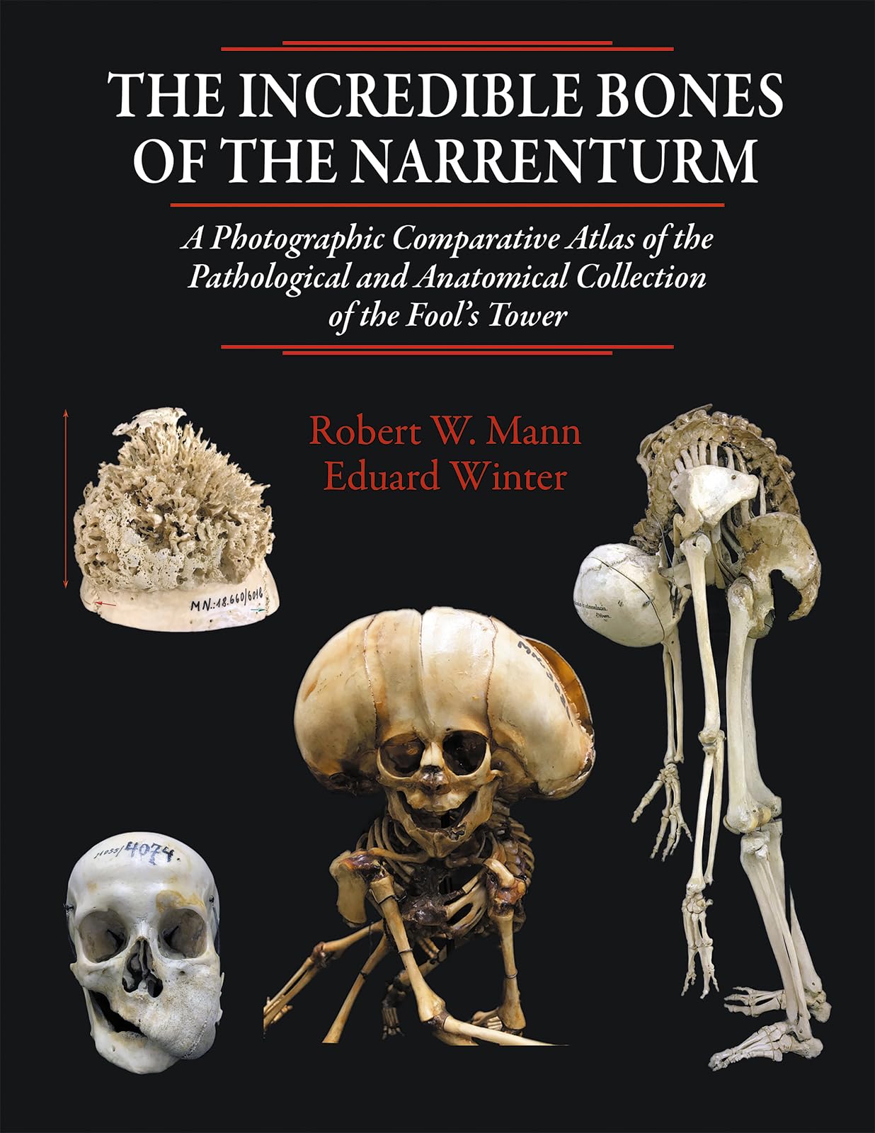 The Incredible Bones of the Narrenturm: Photographic Comparative Atlas of the Pathological and Anatomical Collection of the Fool's Tower Medicine