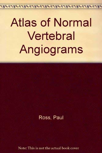 Atlas of Normal Vertebral Angiograms Medicine