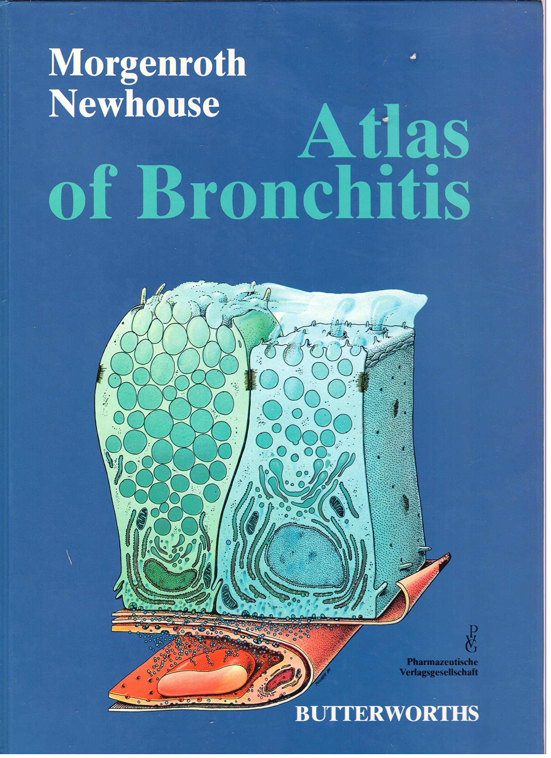 Atlas of Bronchitis Medicine