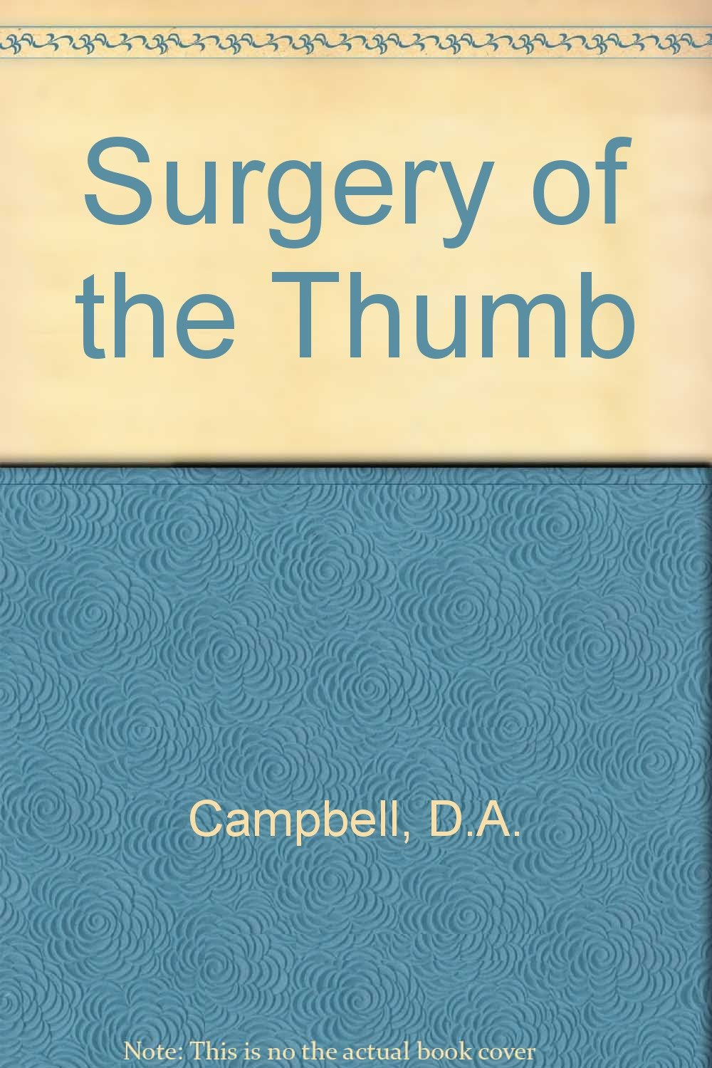 Surgery of the Thumb Medicine