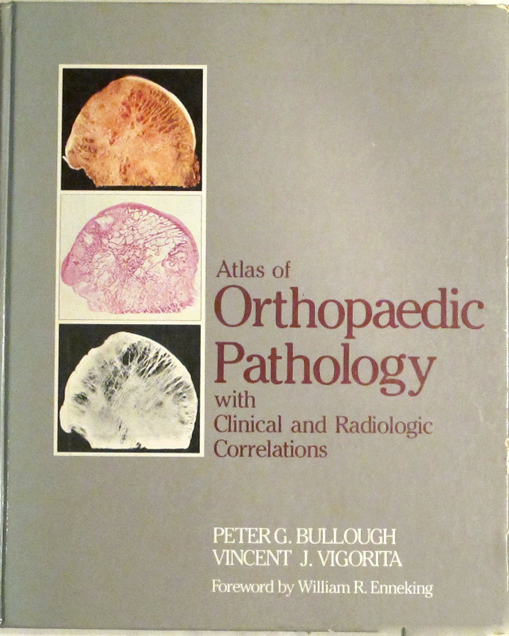 Atlas of Orthopaedic Pathology: With Clinical and Radiologic Correlations Medicine