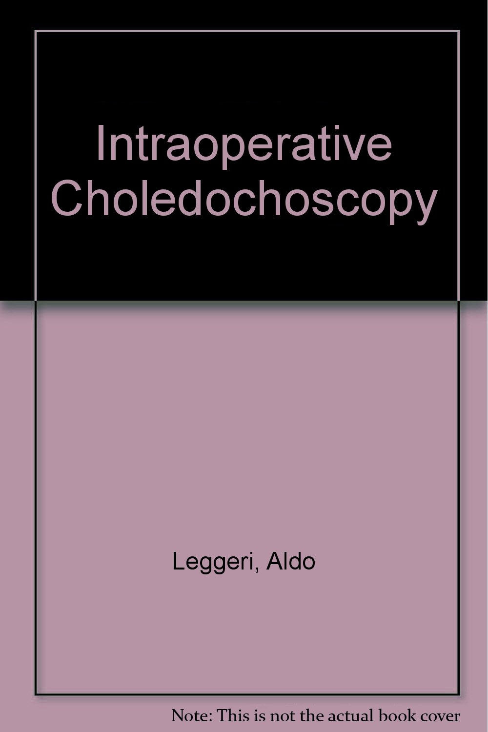 Intraoperative Choledochoscopy Medicine