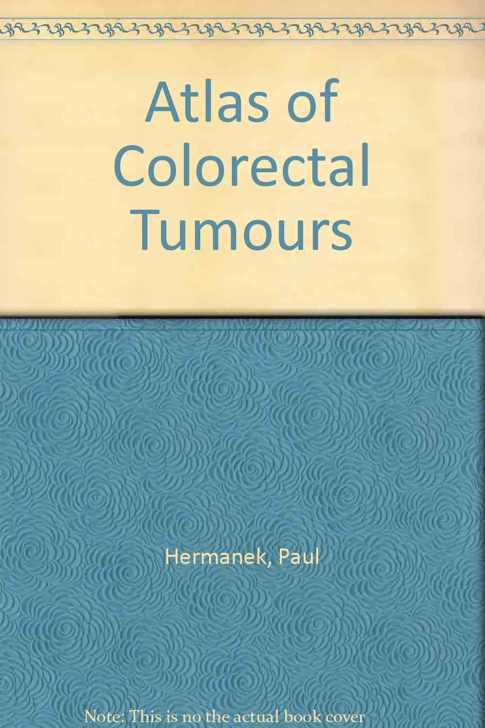 Atlas of Colorectal Tumours Medicine