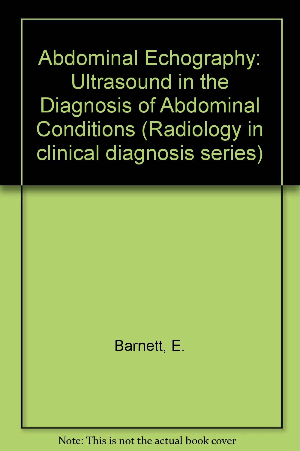Abdominal Echography: Ultrasound in the Diagnosis of Abdominal Conditions Books