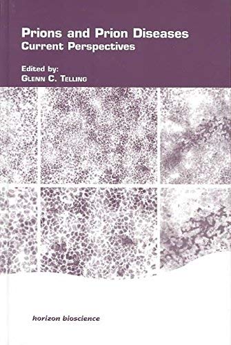 Product Image: Prions and Prion Diseases