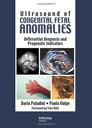 Ultrasound of Congenital Fetal Anomalies: Differential Diagnosis and Prognostic Indicators Medicine
