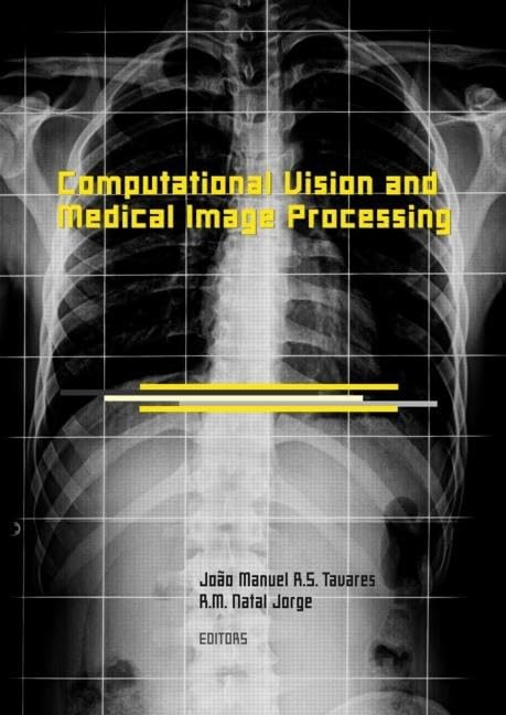 Computational Vision and Medical Image Processing: Vipimage 2007 (Balkema-Proceedings and Monographs in Engineering, Water, an) Medicine