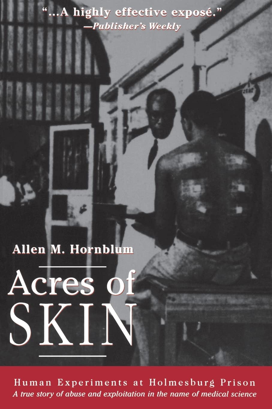 Acres of Skin Law