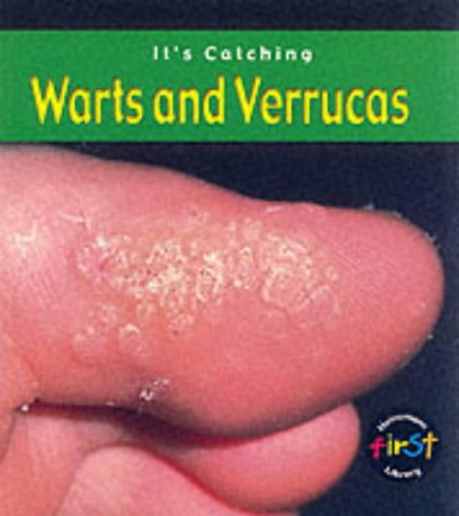 it's Catching: Warts and Verrucas Paperback Non-fiction