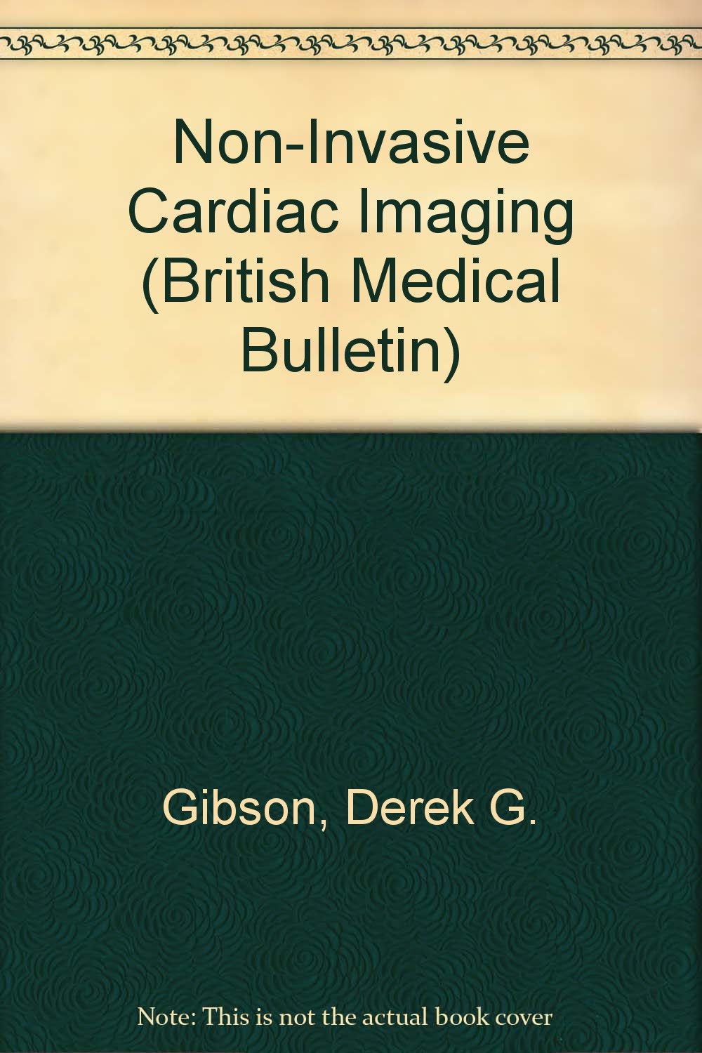 Noninvasive Cardiac Imaging (British Medical Bulletin) Medicine