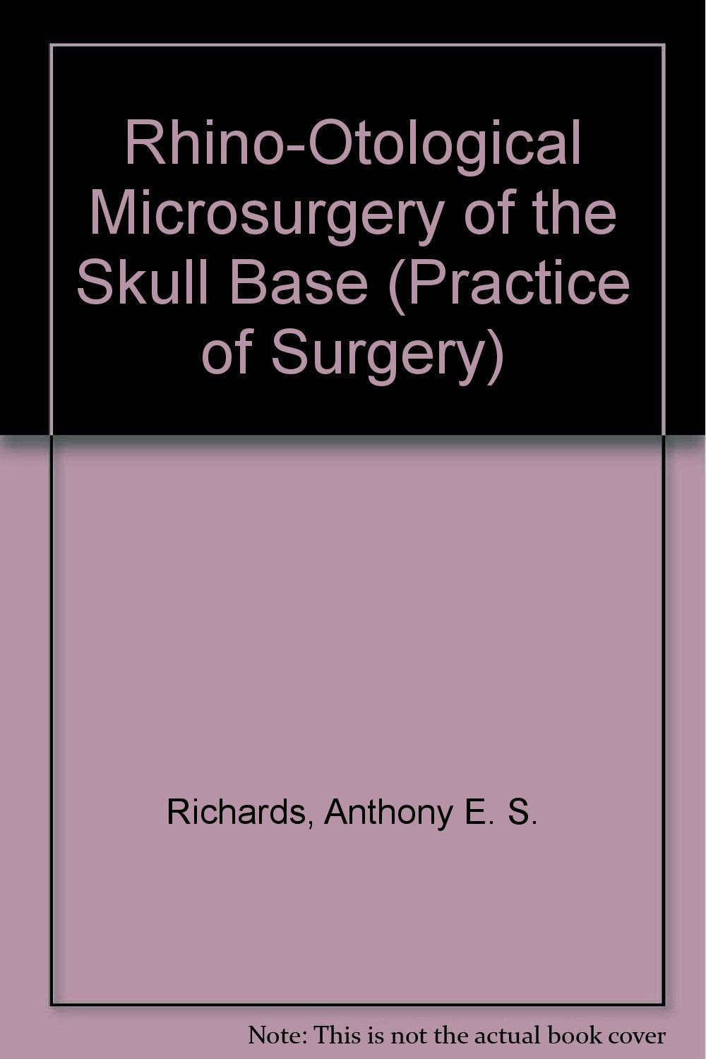 Rhino-Otological Microsurgery of the Skull Base (Practice of Surgery) Medicine