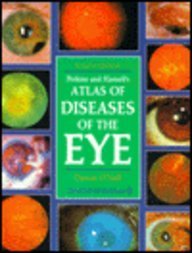 Perkins and Hansell's Atlas of Diseases of the Eye Medicine