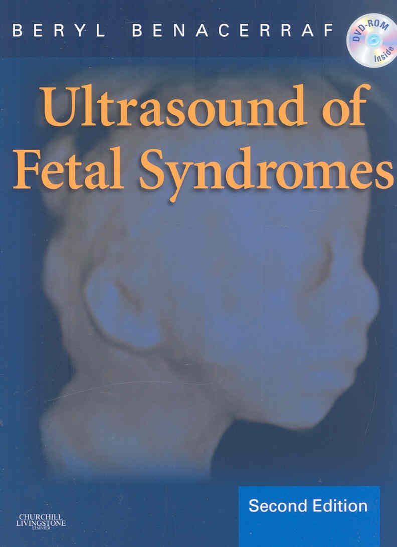 Ultrasound of Fetal Syndromes, w. DVD: Text with DVD Medicine