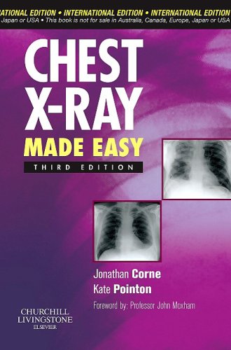 Chest X-Ray Made Easy Third Edition Books