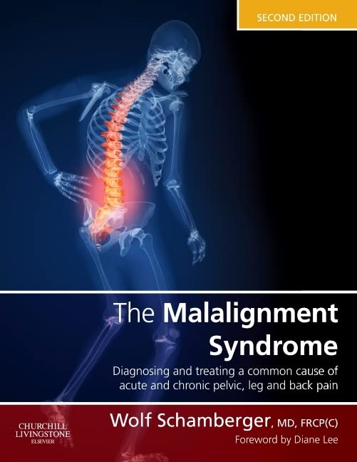 The Malalignment Syndrome: diagnosis and treatment of common pelvic and back pain Medicine