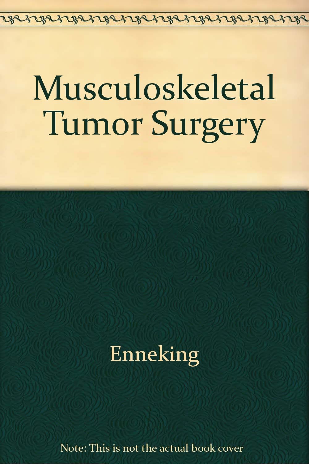 Musculoskeletal Tumour Surgery Medicine