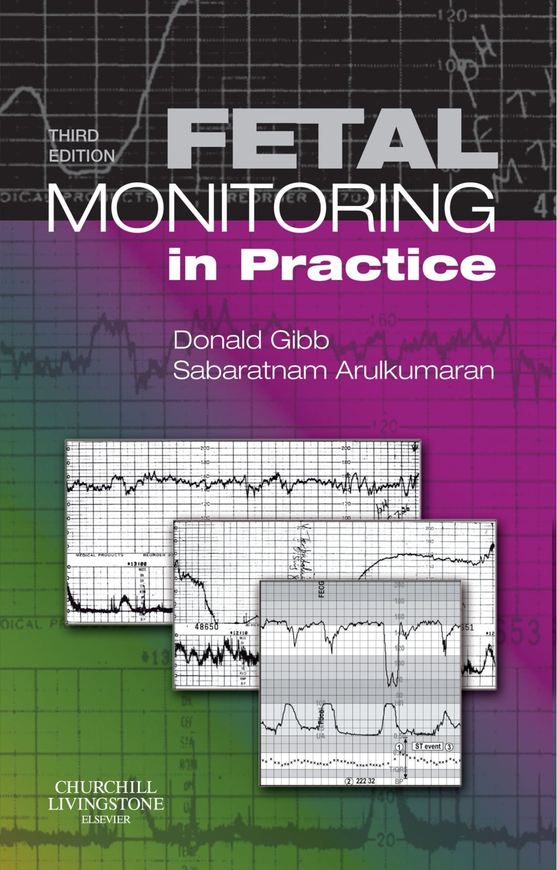 Fetal Monitoring in Practice Medicine