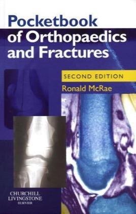 Pocketbook of Orthopaedics and Fractures (Churchill Pocketbooks) Medicine