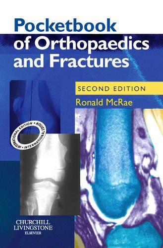 Pocketbook of Orthopaedics and Fractures, International Edition Medicine