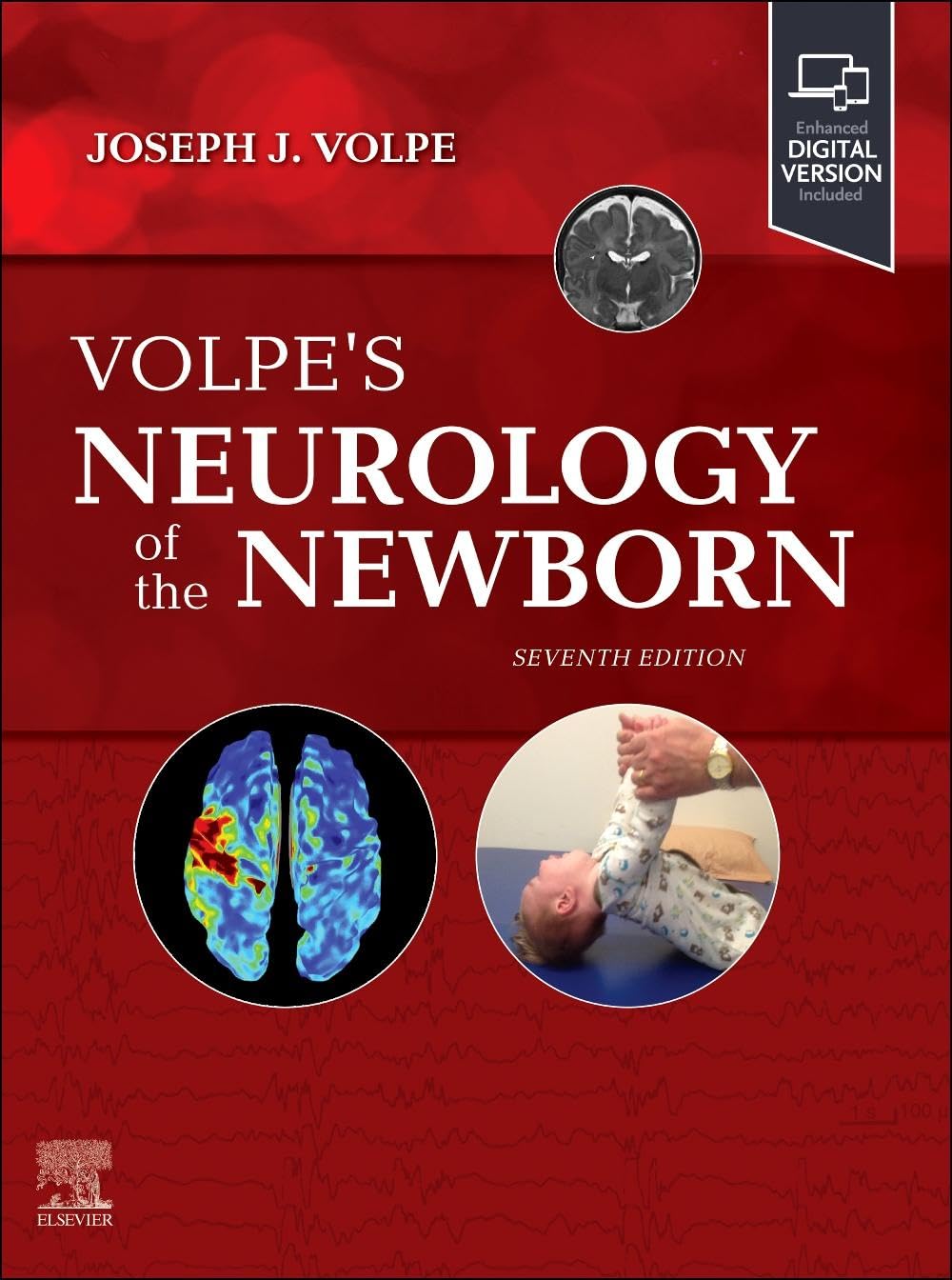 Volpe's Neurology of the Newborn Medicine