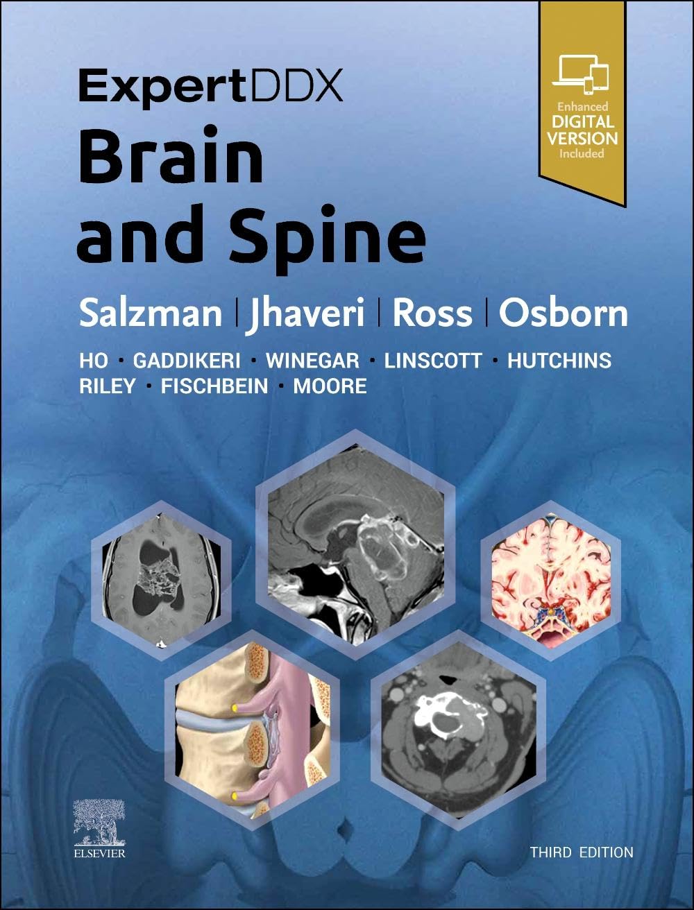 ExpertDDx: Brain and Spine Medicine