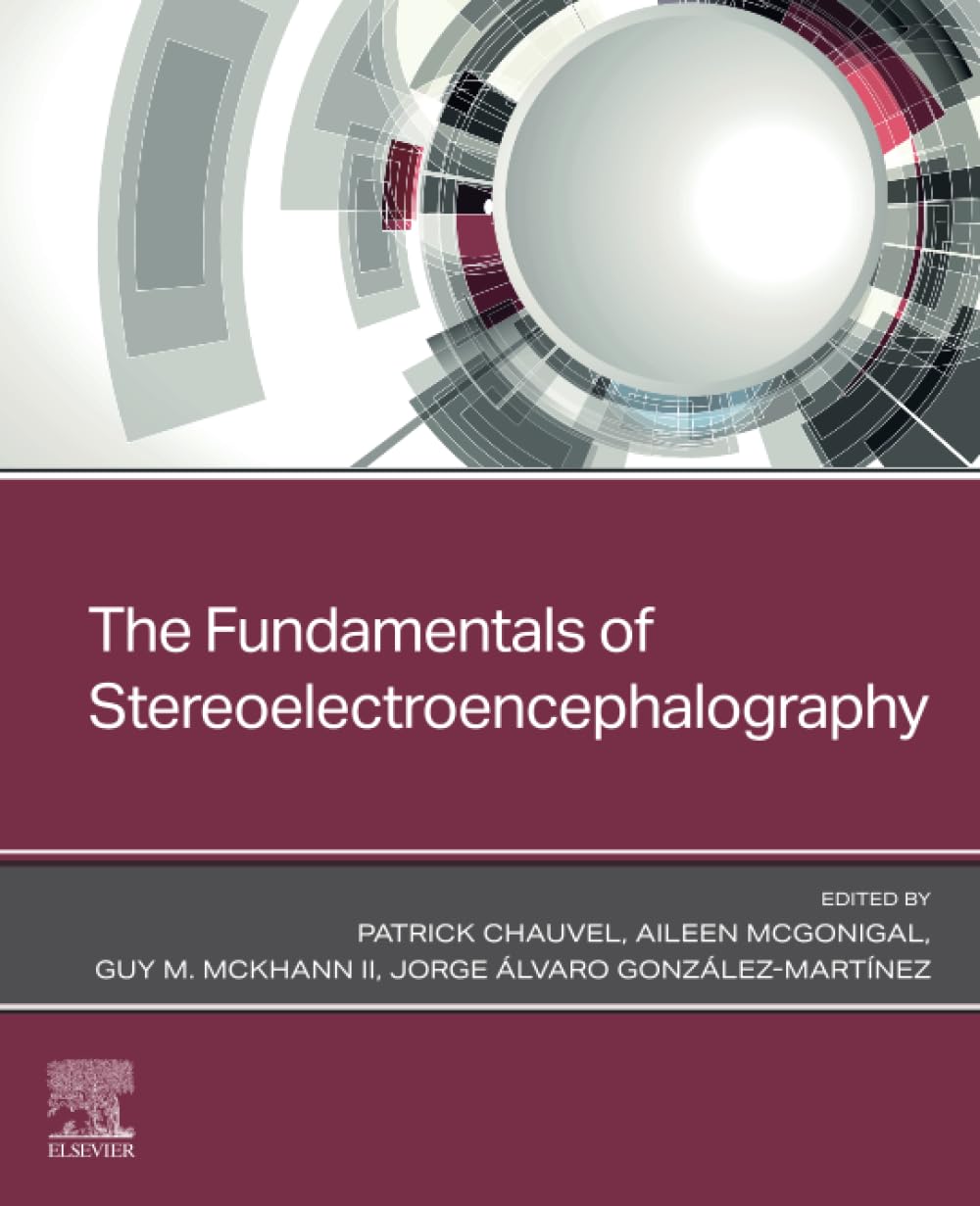 The Fundamentals of Stereoelectroencephalography Medicine