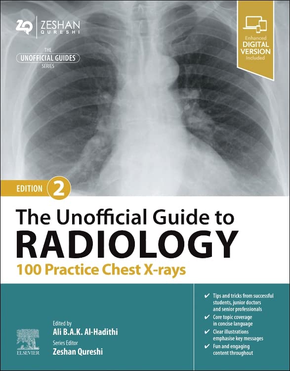 The Unofficial Guide to Radiology: 100 Practice Chest X-rays (Unofficial Guides) Medicine