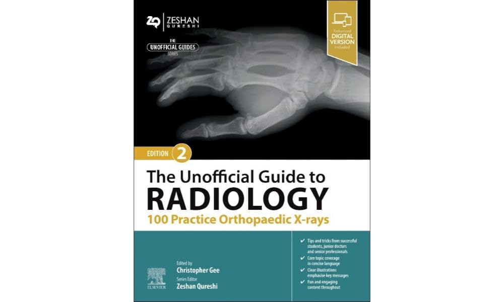 The Unofficial Guide to Radiology: 100 Practice Orthopaedic X-rays (Unofficial Guides) Medicine