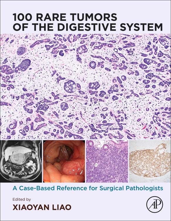 100 Rare Tumors of the Digestive System: A Case-Based Reference for Surgical Pathologists Medicine
