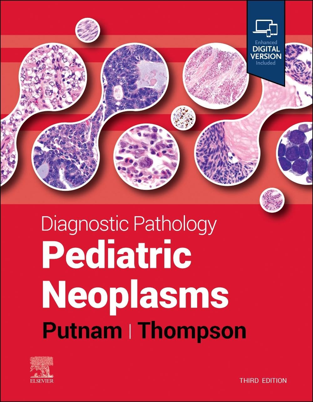 Diagnostic Pathology: Pediatric Neoplasms Medicine