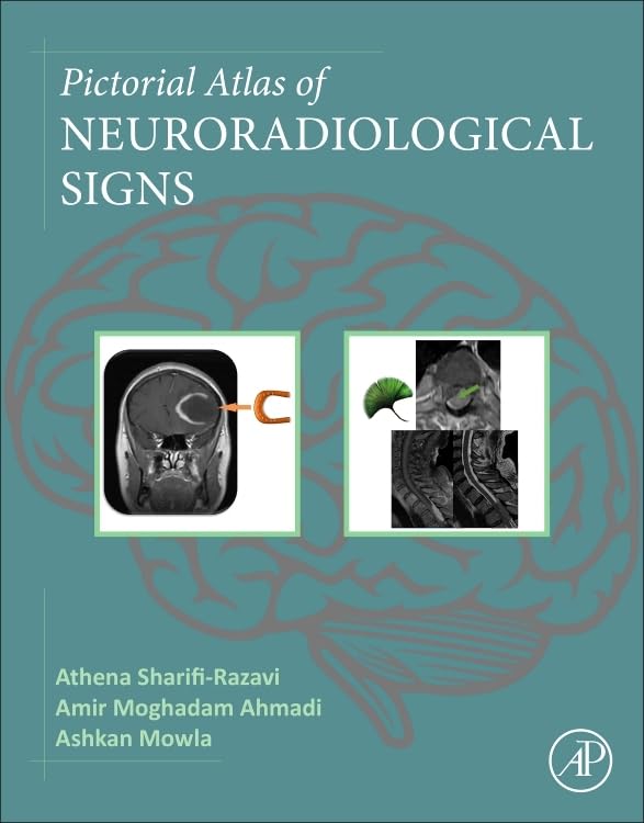 Pictorial Atlas of Neuroradiological Signs Medicine