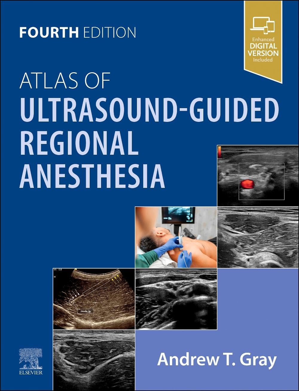 Atlas of Ultrasound-Guided Regional Anesthesia Medicine