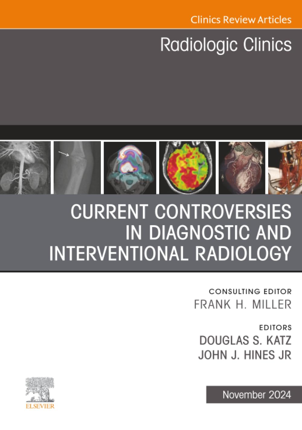 Current Controversies in Diagnostic and Interventional Radiology, An Issue of Radiologic Clinics of North America: Volume 62-6 (The Clinics: Radiology, Volume 62-6) Medicine