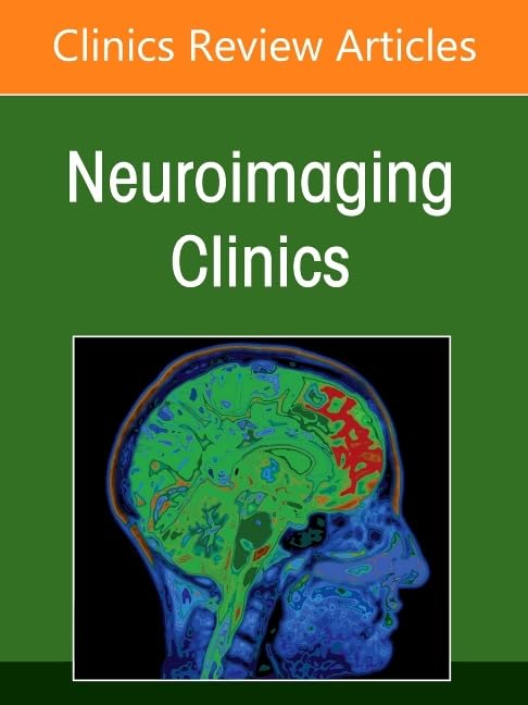 Management and Treatment of Cerebral Aneurysms, An Issue of Neuroimaging Clinics of North America (Volume 35-3) (The Clinics: Radiology, Volume 35-3) Medicine