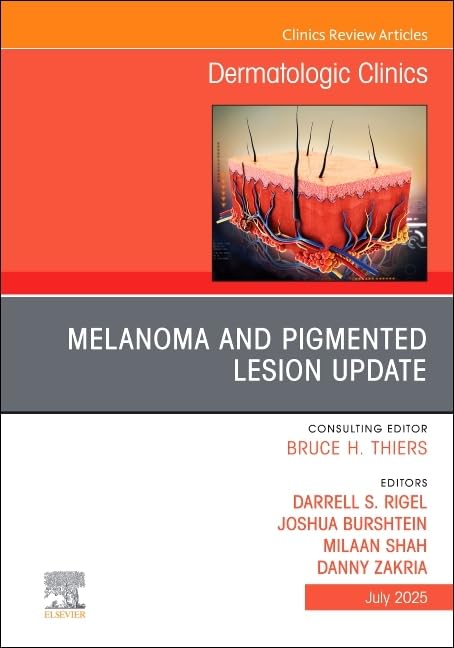 Melanoma and Pigmented Lesion Update, An Issue of Dermatologic Clinics (Volume 43-3) (The Clinics: Dermatology, Volume 43-3) Medicine