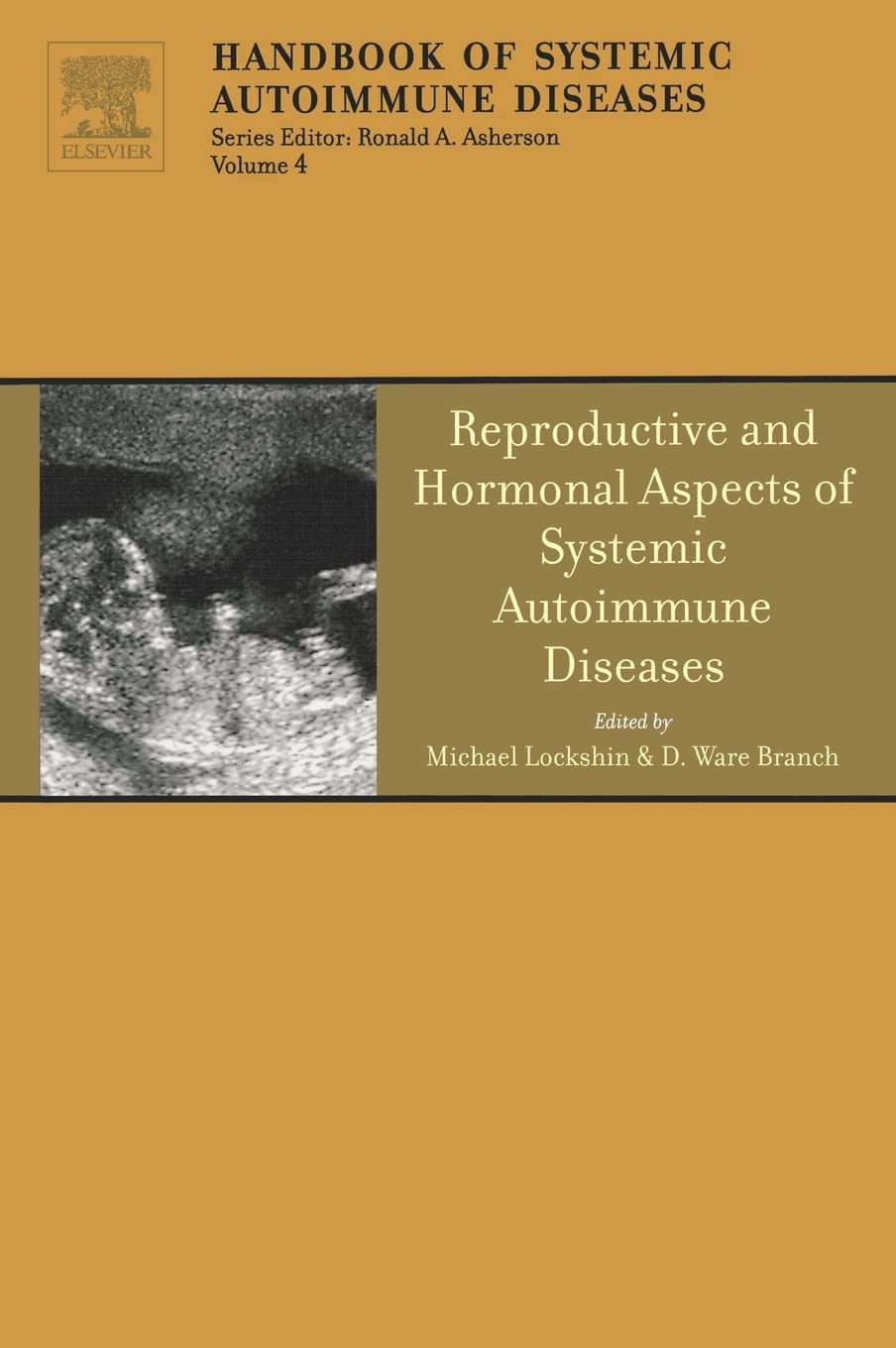Reproductive and Hormonal Aspects of Systemic Autoimmune Diseases (Volume 4) (Handbook of Systemic Autoimmune Diseases, Volume 4, Band 4) Medicine