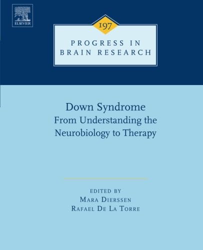 Down Syndrome: From Understanding the Neurobiology to Therapy Medicine