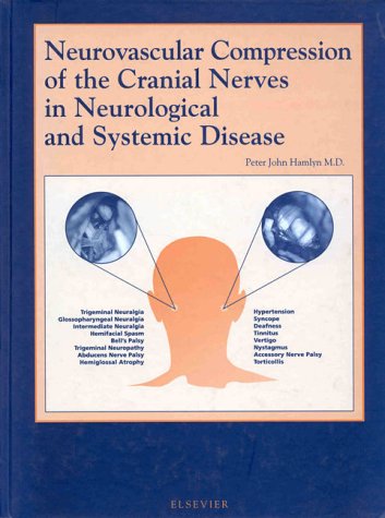 Neurovascular Compression of the Lower Cranial Nerves Medicine