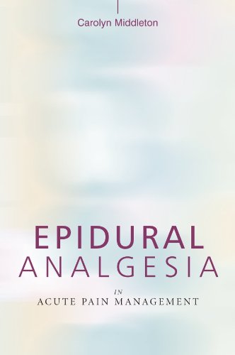 Epidural Analgesia in Acute Pain Management Books