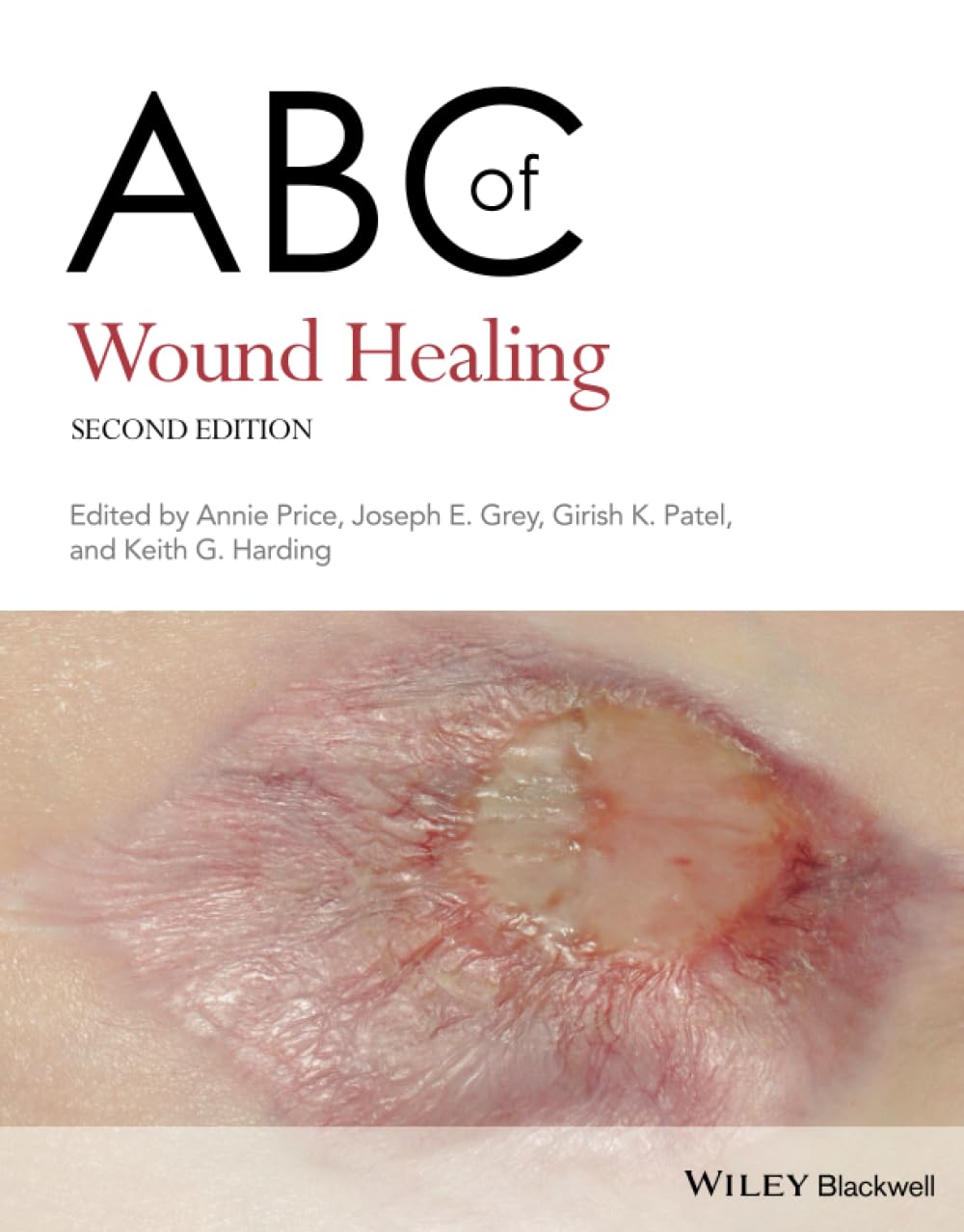 ABC of Wound Healing (ABC Series) Medicine