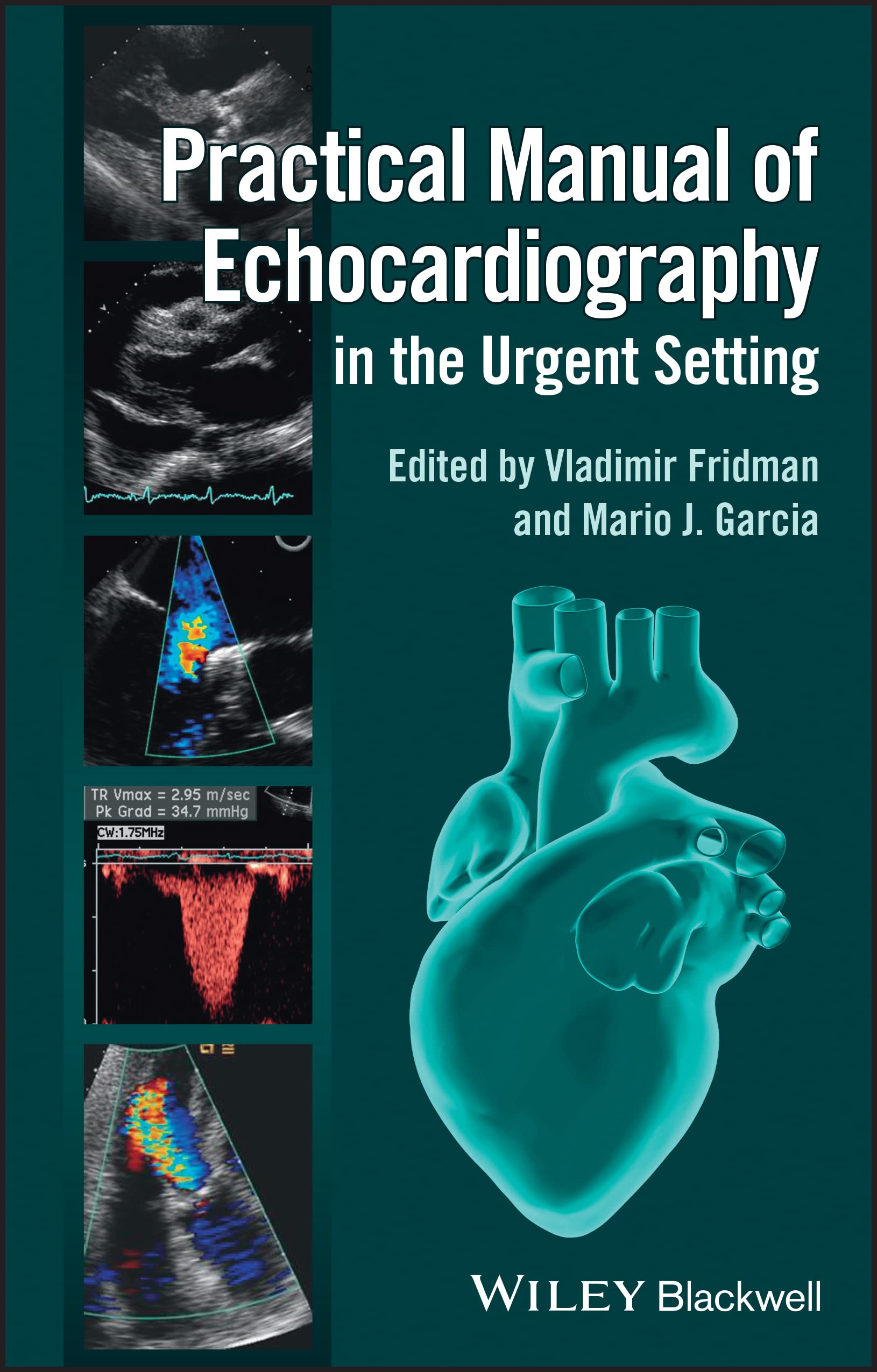 Practical Manual of Echocardiography in the Urgent Setting Medicine
