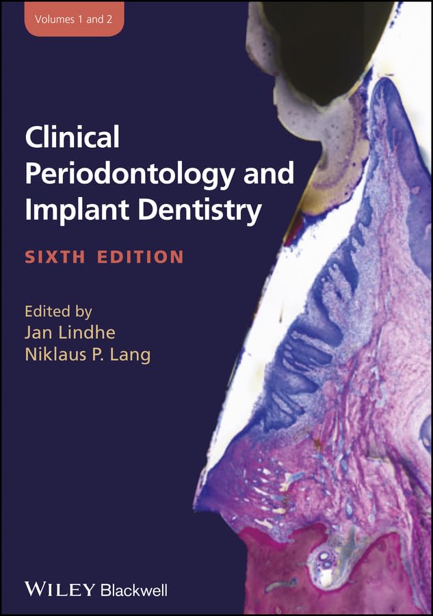 Clinical Periodontology and Implant Dentistry, 2 Pts.: 2 Volume Set Medicine