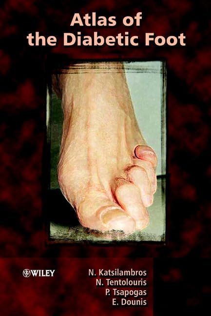 Atlas of the Diabetic Foot: Reference Medicine